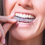 Invisalign Dentists