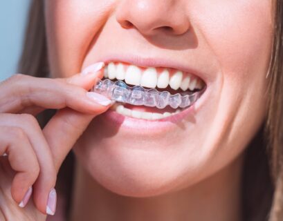 Invisalign Dentists